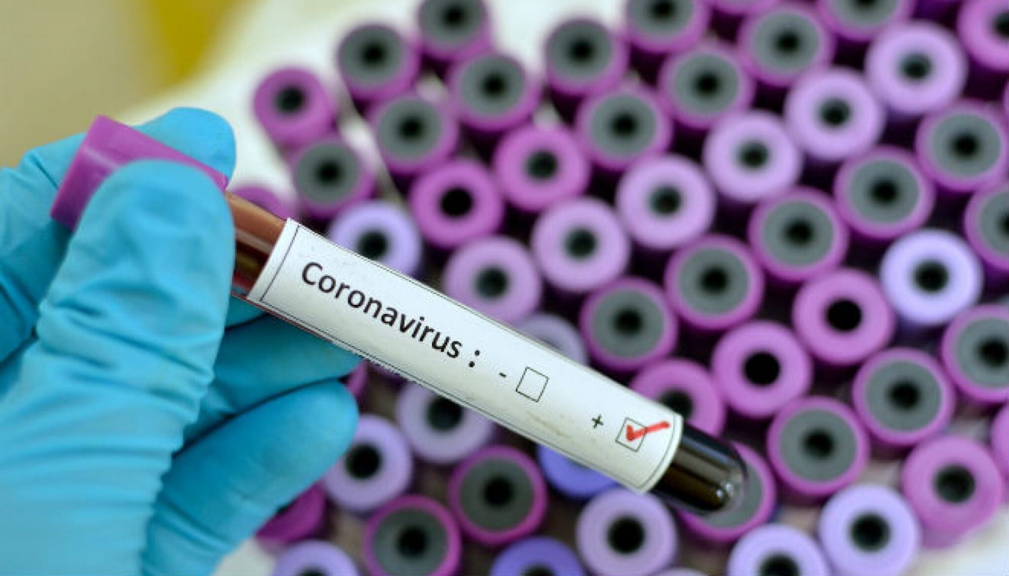 Coronavairus y Blockchain